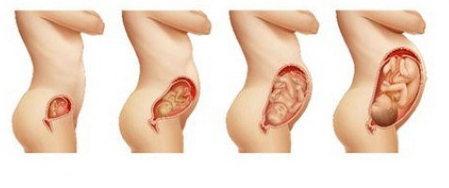 1 Aylık Hamilelikte Karın Ağrısı Belirtileri ve Tedavisi