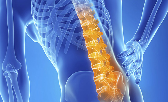 Aşırı Bel Ağrısı Belirtileri ve Tedavisi