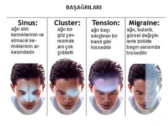 Baş Ağrısı Çeşitleri Nelerdir?