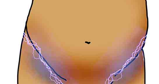 Hamilelikte Kasık Ağrısı Belirtileri ve Tedavisi