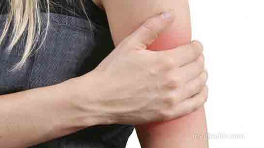 Kol Ağrısı Belirtileri ve Tedavisi