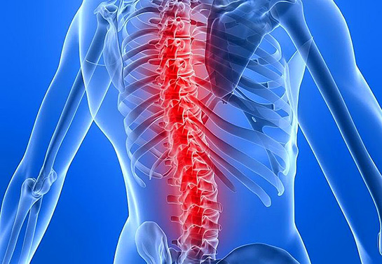 Omuz ve Sırt Ağrısı Belirtileri ve Tedavisi