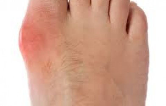 Sağ Ayak Ağrısı Belirtileri ve Tedavisi